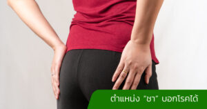 ตำแหน่ง “ชา” บอกโรคได้