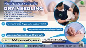 ฝังเข็มแบบสะกิดปม Dry Needling  รักษาอาการปวดคอบ่าไหล่