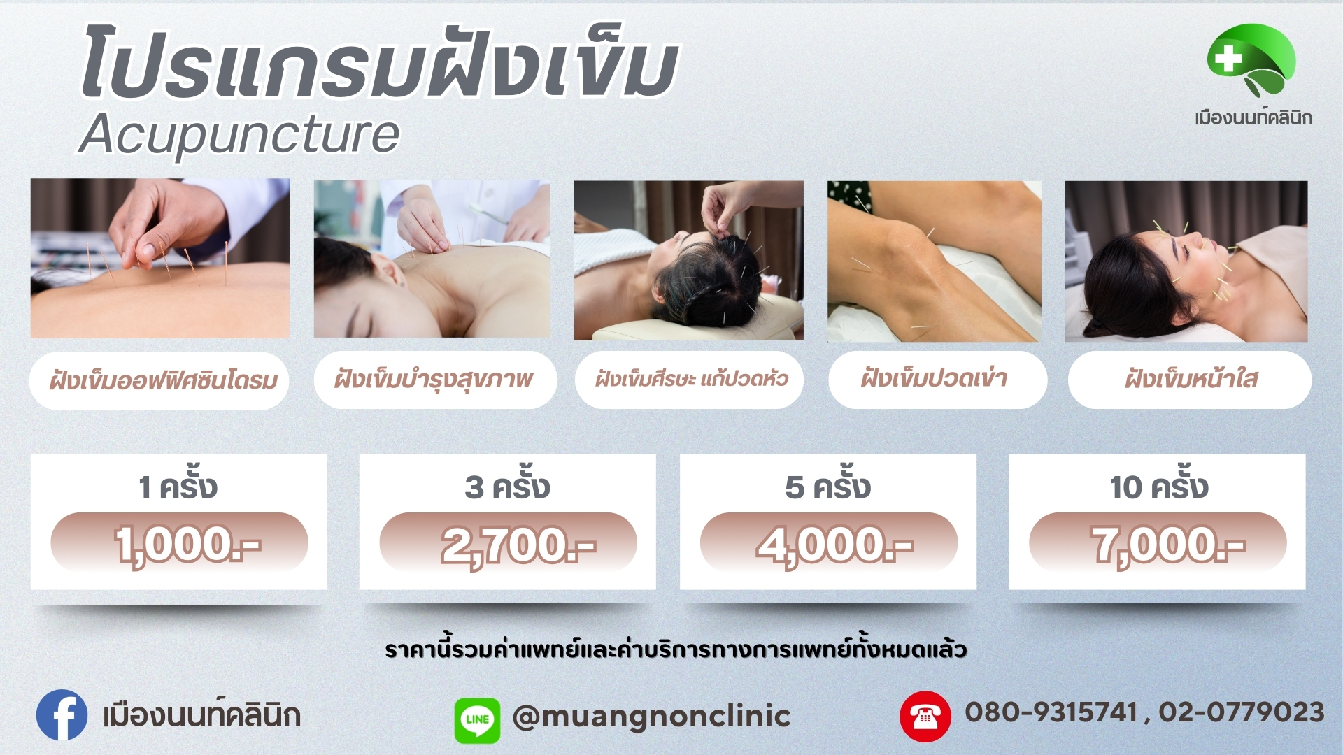โปรแกรมฝังเข็ม Acupuncture